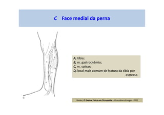 C Face medial da perna
A, tíbia;
B, m. gastrocnêmio;
C, m. solear;
D, local mais comum de fratura da tíbia por
estresse.
Reider, O Exame Físico em Ortopedia – Guanabara Koogan -2001
 