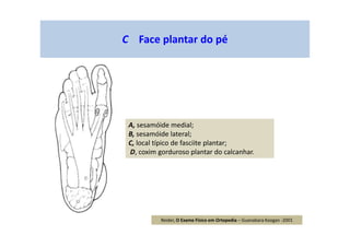 C Face plantar do pé
A, sesamóide medial;
B, sesamóide lateral;
C, local típico de fasciite plantar;
D, coxim gorduroso plantar do calcanhar.
Reider, O Exame Físico em Ortopedia – Guanabara Koogan -2001
 