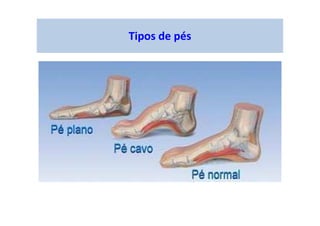figura
Tipos de pés
 