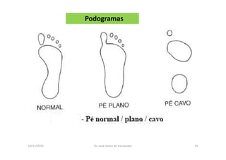 10/12/2015 Dr. José Heitor M. Fernandes 75
Podogramas
 