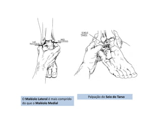 O Maléolo Lateral é mais comprido
do que o Maléolo Medial
Palpação do Seio do Tarso
 