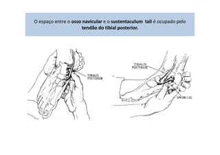O espaço entre o osso navicular e o sustentaculum tali é ocupado pelo
tendão do tibial posterior.
 