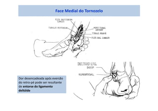 Face Medial do Tornozelo
Dor desencadeada após eversão
do retro-pé pode ser resultante
de entorse do ligamento
deltóide
 