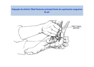 Palpação da Artéria Tibial Posterior principal fonte de suprimento sanguíneo
do pé.
 