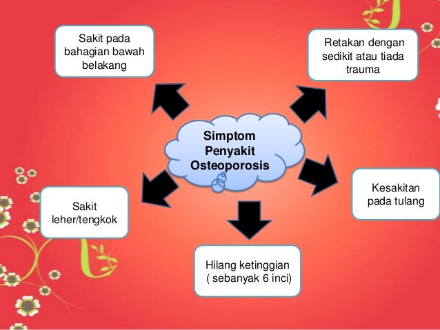 PENYAKIT OSTEOPOROSIS