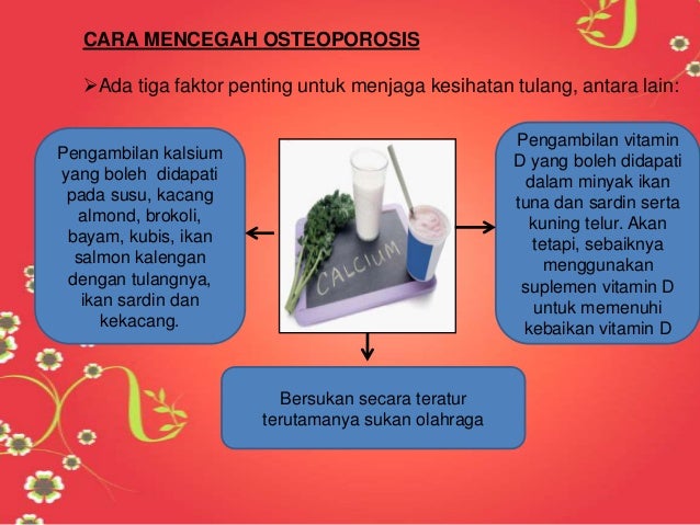 PENYAKIT OSTEOPOROSIS