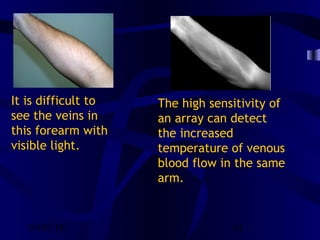 10/02/16 24
It is difficult to
see the veins in
this forearm with
visible light.
The high sensitivity of
an array can detect
the increased
temperature of venous
blood flow in the same
arm.
 
