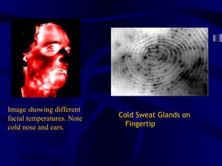 10/02/16 25
Image showing different
facial temperatures. Note
cold nose and ears.
                                                    
Cold Sweat Glands on
Fingertip
 