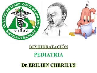 DESHIDRATACIÓN
PEDIATRIA
Dr. ERILIEN CHERILUS
 