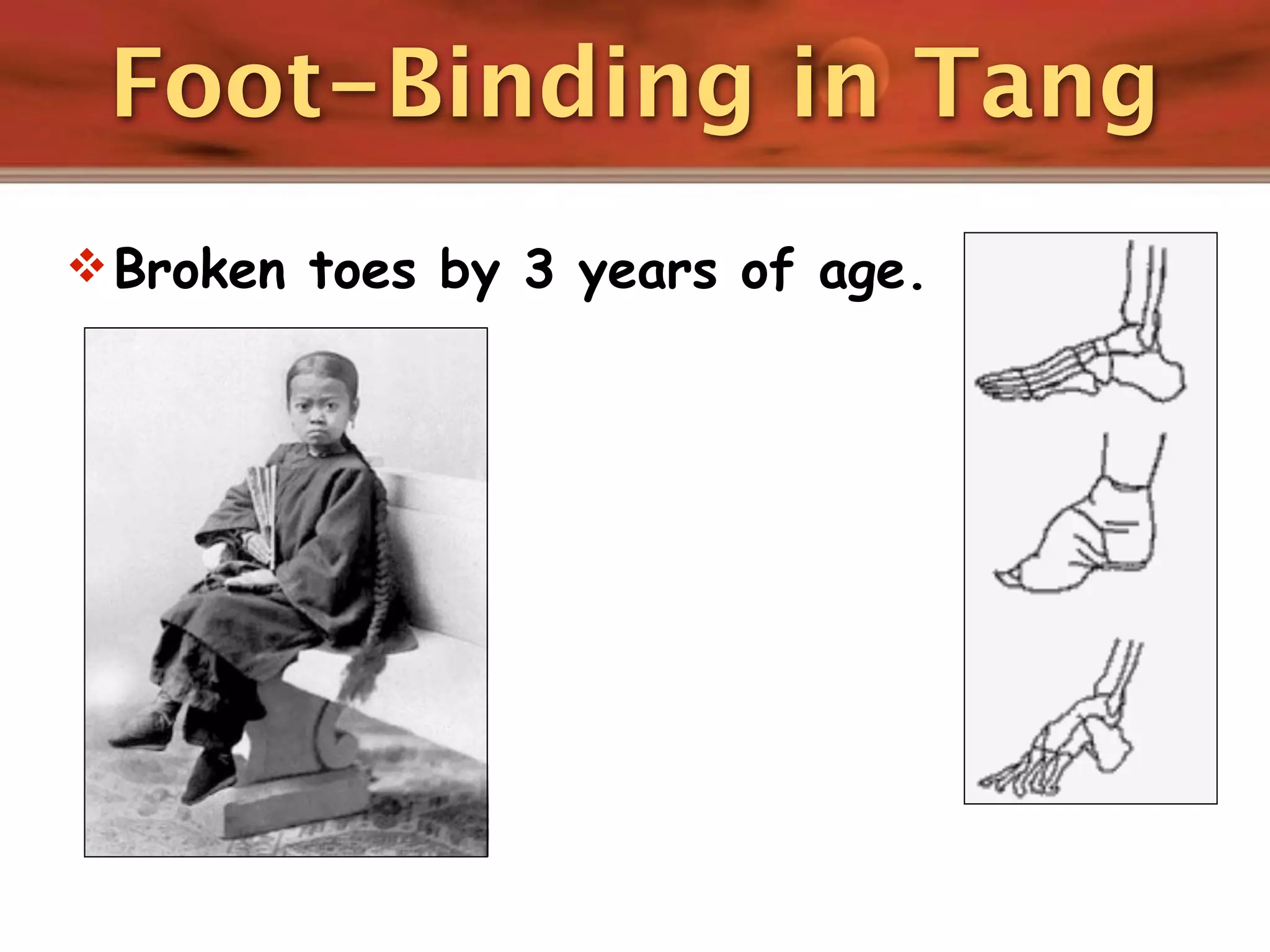 Foot-Binding in Tang
 Broken toes by 3 years of age.
 
