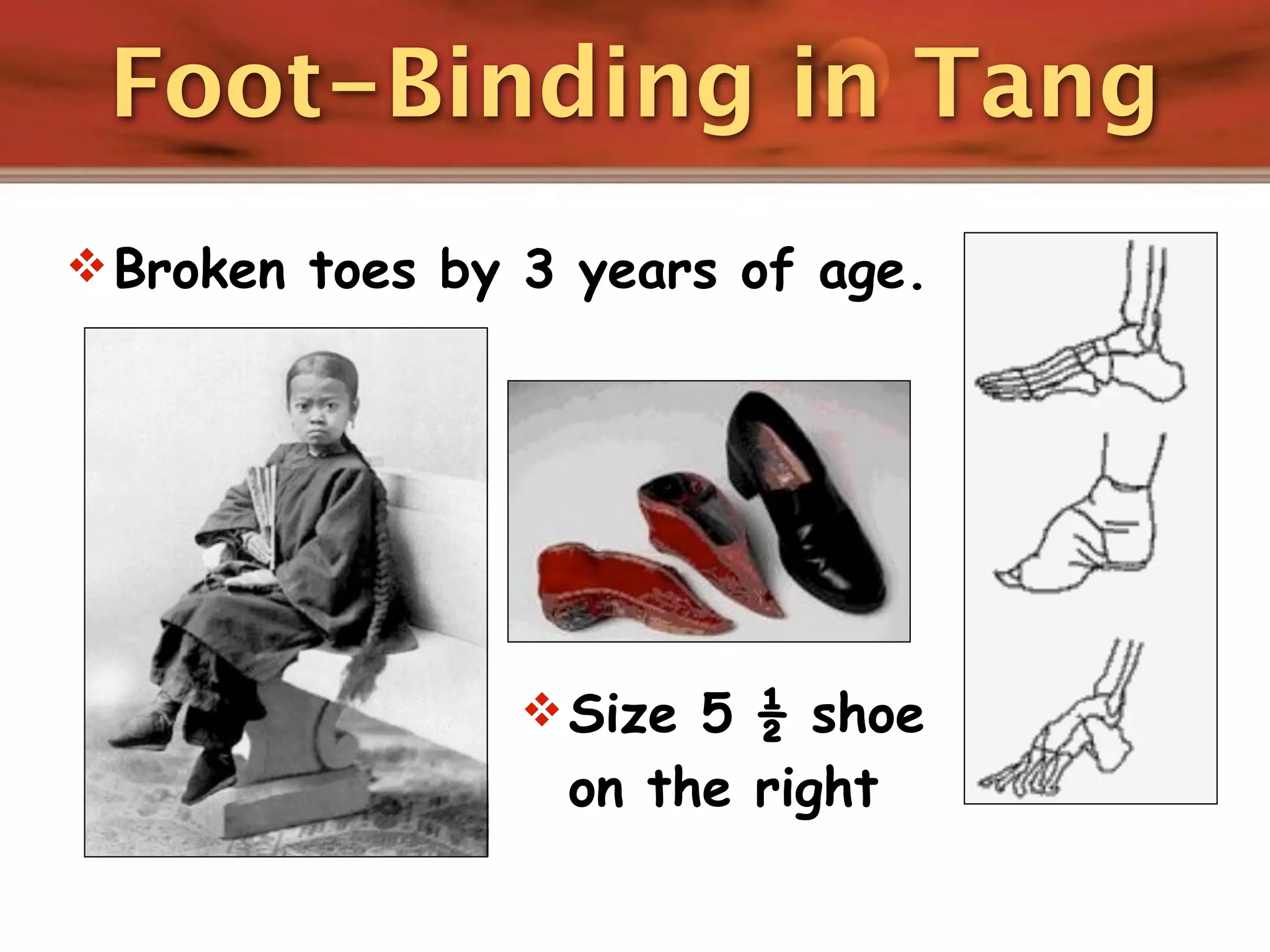 Foot-Binding in Tang
 Broken toes by 3 years of age.




                 Size 5 ½ shoe
                  on the right
 