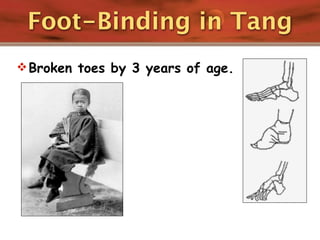Foot-Binding in Tang
 Broken toes by 3 years of age.
 