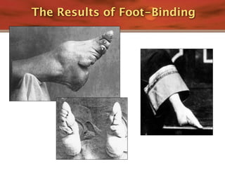 The Results of Foot-Binding
 