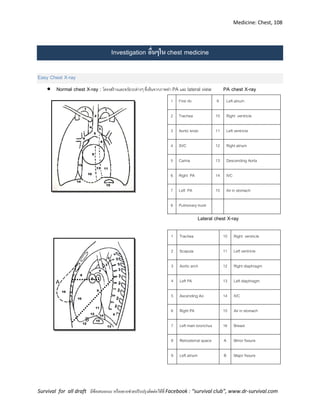 Medicine: Chest, 108
Survival for all draft มีข้อเสนอแนะ หรืออยากช่วยปรับปรุงติดต่อได้ที่ Facebook : “survival club”, www.dr-survival.com
Investigation อื่นๆใน chest medicine
Easy Chest X-ray
 Normal chest X-ray : โครงสร้างและอวัยวะต่างๆ ที่เห็นจากภาพท่า PA และ lateral view PA chest X-ray
1 First rib 9 Left atrium
2 Trachea 10 Right ventricle
3 Aortic knob 11 Left ventricle
4 SVC 12 Right atrium
5 Carina 13 Descending Aorta
6 Right PA 14 IVC
7 Left PA 15 Air in stomach
8 Pulmonary trunk
Lateral chest X-ray
1 Trachea 10 Right ventricle
2 Scapula 11 Left ventricle
3 Aortic arch 12 Right diaphragm
4 Left PA 13 Left diaphragm
5 Ascending Ao 14 IVC
6 Right PA 15 Air in stomach
7 Left main bronchus 16 Breast
8 Retrosternal space A Minor fissure
9 Left atrium B Major fissure
A
B
 