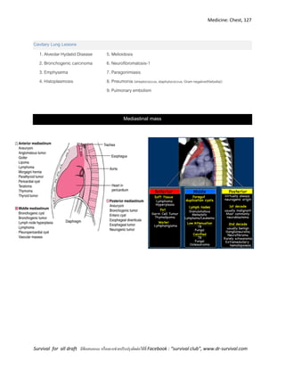 Medicine: Chest, 127
Survival for all draft มีข้อเสนอแนะ หรืออยากช่วยปรับปรุงติดต่อได้ที่ Facebook : “survival club”, www.dr-survival.com
Cavitary Lung Lesions
1. Alveolar Hydatid Disease
2. Bronchogenic carcinoma
3. Emphysema
4. Histoplasmosis
5. Melioidosis
6. Neurofibromatosis-1
7. Paragonimiasis
8. Pneumonia (streptococcus, staphylococcus, Gram negative(Klebsilla))
9. Pulmonary embolism
Mediastinal mass
 