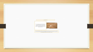 CULTURANAZCA
Nazca es una culturaarqueológicadel AntiguoPerú que
se desarrollóbásicamenteen los valles del actual
departamentode Ica, alrededordel sigloI y entró en
decadenciaen el sigloVII. Su centro estaba ubicadoen
Cahuachi, en el margen izquierdodel Río Grande, en la
actual provinciade Nazca.
Su centro estaba ubicadoen Cahuachi,en el margenizquierdodel Río Grande, en la actual provinciade Nazca. Su territorio
llegóa abarcardesde Chincha por el norte, hasta Arequipapor el sur. Hasta el sigloVI d. C., aumentaronsus contactos con la
zonaandina, llegandoinclusivehasta las zonas altas de Ayacucho.
 