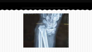 Curso de anatomia radiológica exercicios