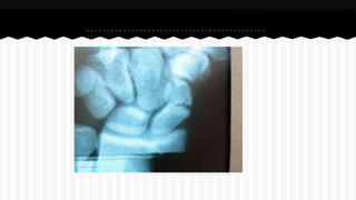 Curso de anatomia radiológica exercicios