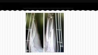 Curso de anatomia radiológica exercicios