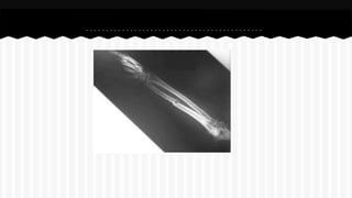 Curso de anatomia radiológica exercicios