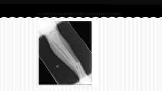 Curso de anatomia radiológica exercicios