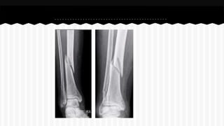 Curso de anatomia radiológica exercicios