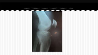 Curso de anatomia radiológica exercicios