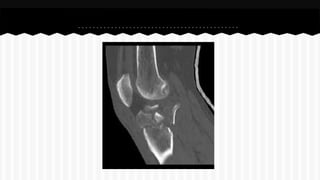 Curso de anatomia radiológica exercicios