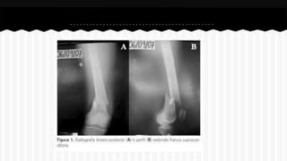 Curso de anatomia radiológica exercicios