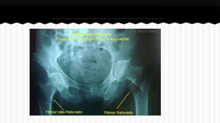 Curso de anatomia radiológica exercicios