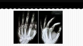 Curso de anatomia radiológica exercicios