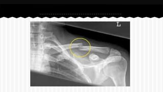 Curso de anatomia radiológica exercicios