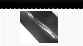 Curso de anatomia radiológica exercicios