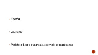 ▪ Edema
▪ Jaundice
▪ Petichae-Blood dyscrasia,asphyxia or septicemia
 