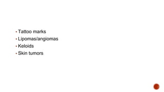 ▪ Tattoo marks
▪ Lipomas/angiomas
▪ Keloids
▪ Skin tumors
 