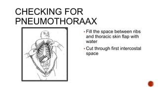 CHECKING FOR
PNEUMOTHORAAX
▪ Fill the space between ribs
and thoracic skin flap with
water
▪ Cut through first intercostal
space
 