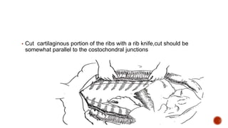 ▪ Cut cartilaginous portion of the ribs with a rib knife,cut should be
somewhat parallel to the costochondral junctions
 