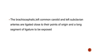 ▪ The brachiocephalic,left common carotid and left subclavian
arteries are ligated close to their points of origin and a long
segment of ligature to be exposed
 