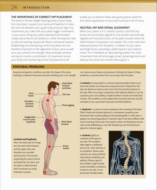 24 I N T R O D U C T I O N
THE IMPORTANCE OF CORRECT HIP PLACEMENT
The pelvis is the key weight-bearing center of your body.
Not only does it support your spine and head but it is also
the vital link between your upper body and your legs. Any
movements you make with your pelvis trigger movements
in your spine: tilting your pelvis backward and forward
creates spinal flexion and extension, while moving from side
to side and twisting causes side flexion and spinal rotation.
Establishing and maintaining correct hip placement are
therefore important to the alignment of your spine as well
as to your overall core strength. Most everyday activities
and sports involve a combination of movements across
your body and maintaining correct hip placement will
enable you to perform these with good posture and form,
thus reducing pressure on your spine and your risk of injury.
NEUTRAL HIP AND SPINAL ALIGNMENT
When your pelvis is in a “neutral” position, the front hip
bones are horizontally aligned to one another and vertically
aligned with the pubic bone, so the pelvis should neither be
tilted forward or backward, nor rotated. This is the most even
balanced position for the pelvis, in relation to your spine
and thigh bones, providing a stable base for your body to
move. This is therefore an ideal starting position for most
movements that will encourage correct spinal alignment and
balance the joints and muscles that support it.
Exaggerated
curve in spine
(kyphosis)
Head tilted
forward
and down
Neck
ﬂexed
Pelvis tilted
forward
Chest sagging
Knees
locked
 ■ Lordosis (or sway back) is a common postural problem that occurs
when the lumbar curve becomes overpronounced. Viewed from the
side, the abdomen tends to stick out to the front and the buttocks to
the rear. Often occurring in conjunction with kyphosis (below), it can be
caused by poor core stability, or tight hip ﬂexor muscles and weak back
muscles. The condition can be treated with corrective exercises, but left
untreated, it can cause lower-back pain and disk problems.
 ■ Kyphosis is a spinal curvature leading to the rounding of the back.
Often linked with lordosis (above) it is sometimes caused by over-
shortened chest muscles pulling on the shoulder girdle. In mild cases, it
appears as a slouching posture; in extreme cases it can leave sufferers with
severe hunching. Most cases only require routine monitoring but serious
ones can be debilitating, or even life threatening, due to the pressure
placed on internal organs.
 ■ Scoliosis (right) is a
curvature of the spine to
one side. The condition
often begins in childhood
and can be mild, with few or
no symptoms. Severe cases,
however, can cause problems
with posture, breathing, and
walking. Obvious signs of
the condition might include
uneven shoulders, a tendency
to lean to one side, or one
prominent shoulder blade.
Shoulders
hunched
(lordosis)
Chin low
Acquired and genetic conditions can alter the shape of the spine,
resulting in impaired movement and pain. Building your core strength
can improve your balance and posture, limiting the impact of these
problems, or prevent them from occurring in the ﬁrst place.
POSTURAL PROBLEMS
Lordosis and kyphosis
Here, the head and chin hang
low, the neck sticks forward,
and the upper back and
shoulders are rounded
and hunched. The muscles
supporting the spinal column
and abdomen are slack, and
the pelvis is tilted forward,
which produces an overly
hollowed-out back.
 