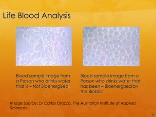 Life Blood Analysis




     Blood sample image from           Blood sample image from a
     a Person who drinks water         Person who drinks water that
     that is – Not Bioenergised.       has been – Bioenergised by
                                       the BioDisc.

  Image Source: Dr Carlos Orozco. The Australian Institute of Applied
  Sciences
                                                                        30
 