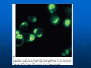 Chlamydia | PDF