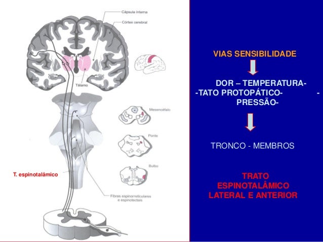 Sensibilidade