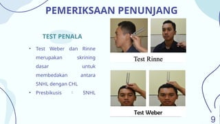 Quality of Life Presbikusis patient pptx | PPTX