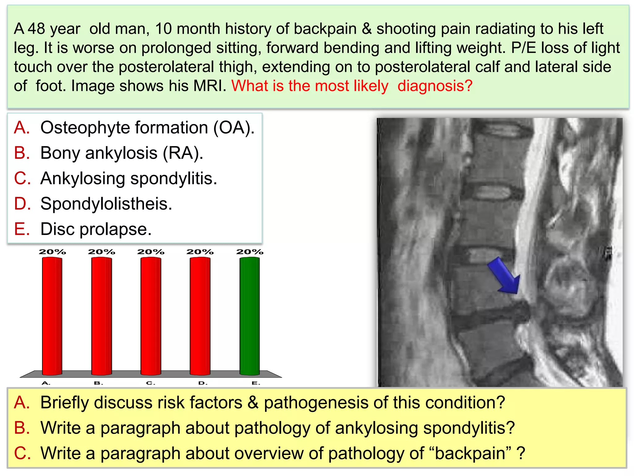 SLE, Myopathy