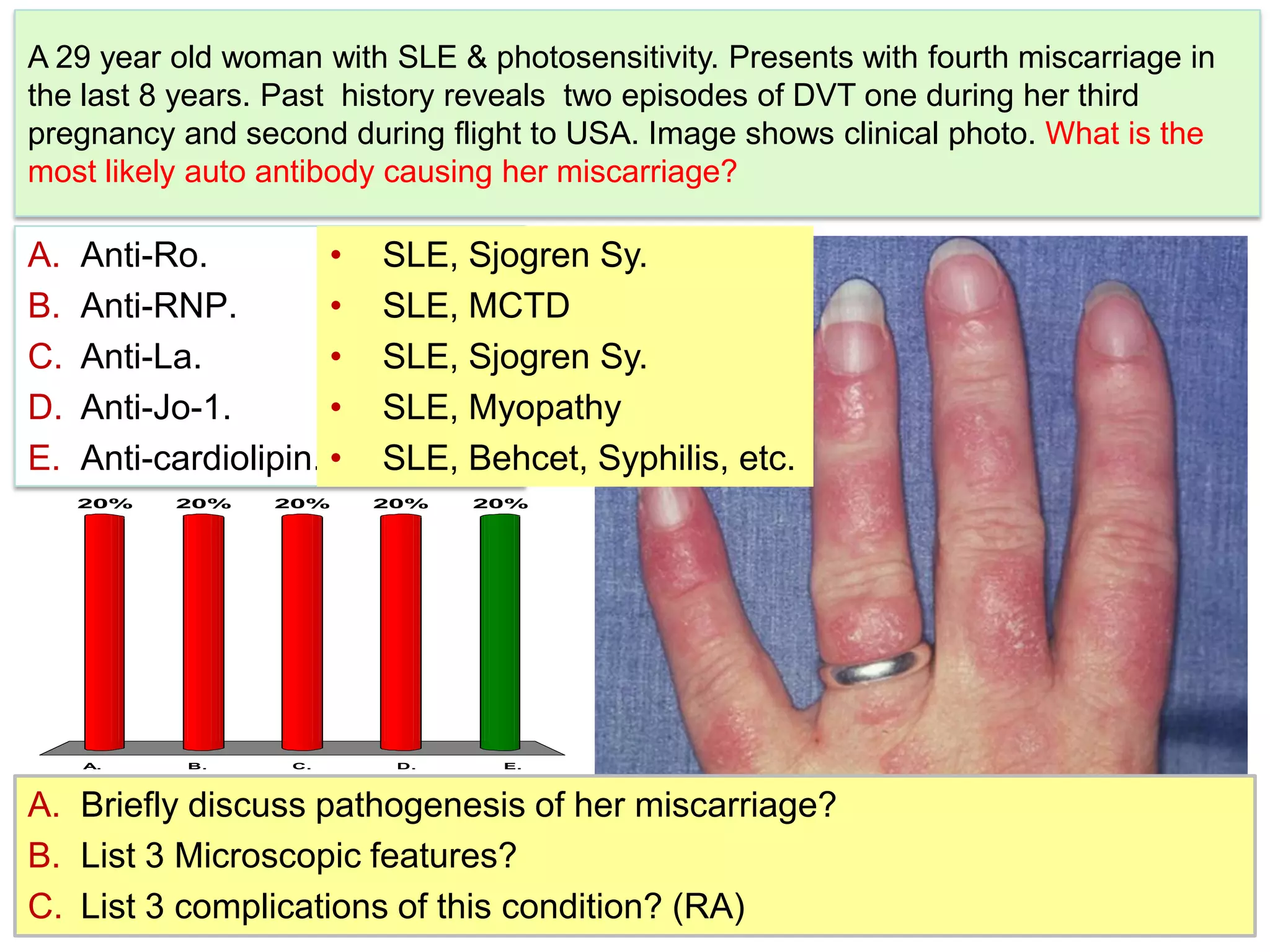 A 29 year old woman with SLE & photosensitivity. Presents with fourth miscarriage in the last 8 years. Past  history reveals  two episodes of DVT one during her third pregnancy and second during flight to USA. Image shows clinical photo. What is the most likely auto antibody causing her miscarriage?Anti-Ro.Anti-RNP.Anti-La.Anti-Jo-1.Anti-cardiolipin.SLE, SjogrenSy.