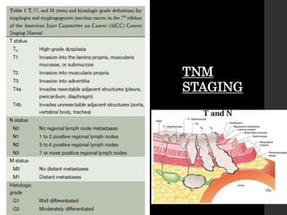 TNM
STAGING
 