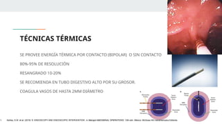 TÉCNICAS TÉRMICAS
SE PROVEE ENERGÍA TÉRMICA POR CONTACTO (BIPOLAR) O SIN CONTACTO
80%-95% DE RESOLUCIÓN
RESANGRADO 10-20%
SE RECOMIENDA EN TUBO DIGESTIVO ALTO POR SU GROSOR.
COAGULA VASOS DE HASTA 2MM DIÁMETRO
1. Ashley, S.W. et al. (2019) ‘5: ENDOSCOPY AND ENDOSCOPIC INTERVENTION’, in Maingot ABDOMINAL OPERATIONS. 13th edn. México: McGraw-Hill Interamericana Editores.
 