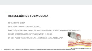 RESECCIÓN DE SUBMUCOSA
SE USA CORTE O LIGA
SE USA CAP EN PUNTA DEL ENDOSCOPIO,
INYECCIÓN DE SALINA A PRIORI, SE SUCCIONA LESIÓN Y SE RESECA CON ELECTROCAUTERIO
RIESGO DE PERFORACIÓN ESPECIALMENTE EN EL CIEGO
LA LIGA PUEDE TRANSFORMAR UNA LESIÓN SÉSIL A UNA PEDICULADA
1. Ashley, S.W. et al. (2019) ‘5: ENDOSCOPY AND ENDOSCOPIC INTERVENTION’, in Maingot ABDOMINAL OPERATIONS. 13th edn. México: McGraw-Hill Interamericana Editores.
 