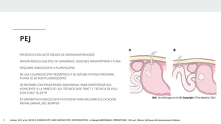PEJ
PACIENTES CON ALTO RIESGO DE BRONCOASPIRACIÓN
MAYOR RIESGO QUE PEG DE SANGRADO, LESIONES INADVERTIDAS Y FUGA
REQUIERE ENDOSCOPIA Y FLUROSCOPIA
SE USA COLONOSCOPIO PEDIÁTRICO Y SE INTUBA YEYUNO PROXIMAL
PUNTA SE VE POR FLUOROSCOPIO
SE DEPRIME CON PINZA PARED ABDOMINAL PARA IDENTIFICAR ASA
ADYACENTE A LA PARED SE USA TÉCNICA SAFE TRACT Y TÉCNICA DE PULL
CON TUBO 16-20 FR
ES IMPERATIVO ENDOSCOPIA POSTERIOR PARA VALORAR COLOCACIÓN
INTRALUMINAL DEL BUMPER
1. Ashley, S.W. et al. (2019) ‘5: ENDOSCOPY AND ENDOSCOPIC INTERVENTION’, in Maingot ABDOMINAL OPERATIONS. 13th edn. México: McGraw-Hill Interamericana Editores.
 