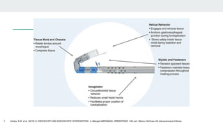 1. Ashley, S.W. et al. (2019) ‘5: ENDOSCOPY AND ENDOSCOPIC INTERVENTION’, in Maingot ABDOMINAL OPERATIONS. 13th edn. México: McGraw-Hill Interamericana Editores.
 